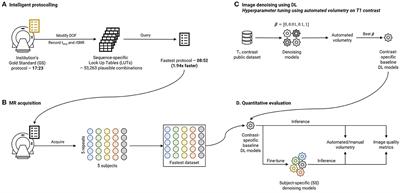 Accelerated MRI using intelligent protocolling and subject-specific denoising applied to Alzheimer's disease imaging